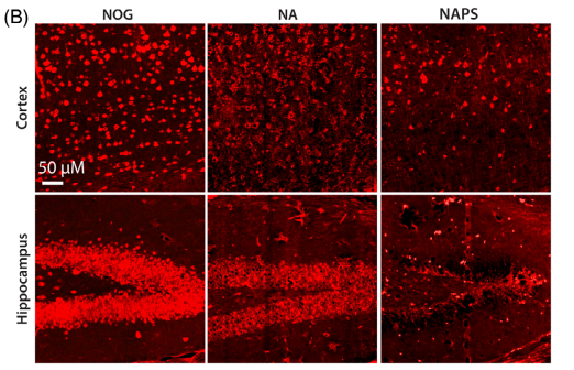 神经元丢失与脑萎缩：NeuN/MAP2染色：显示NA和NAPS小鼠皮质及海马神经元显著丢失